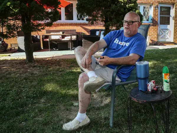 Federal drug testing rules led to problems for Todd Douglas, a medical marijuana patient and Philadelphia Gas Works employee. But he didn’t want to stop using cannabis to treat his pain. (Steven M. Falk of The Philadelphia Inquirer)